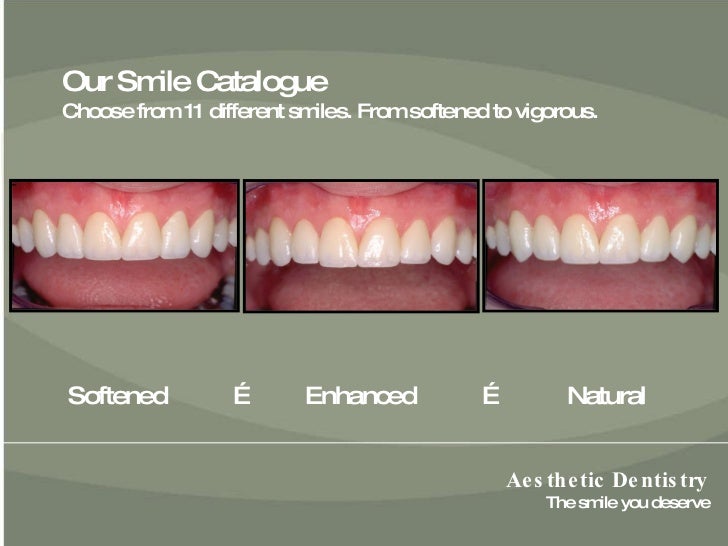 Seattle Cosmetic Laser Dentist Lance Timmerman