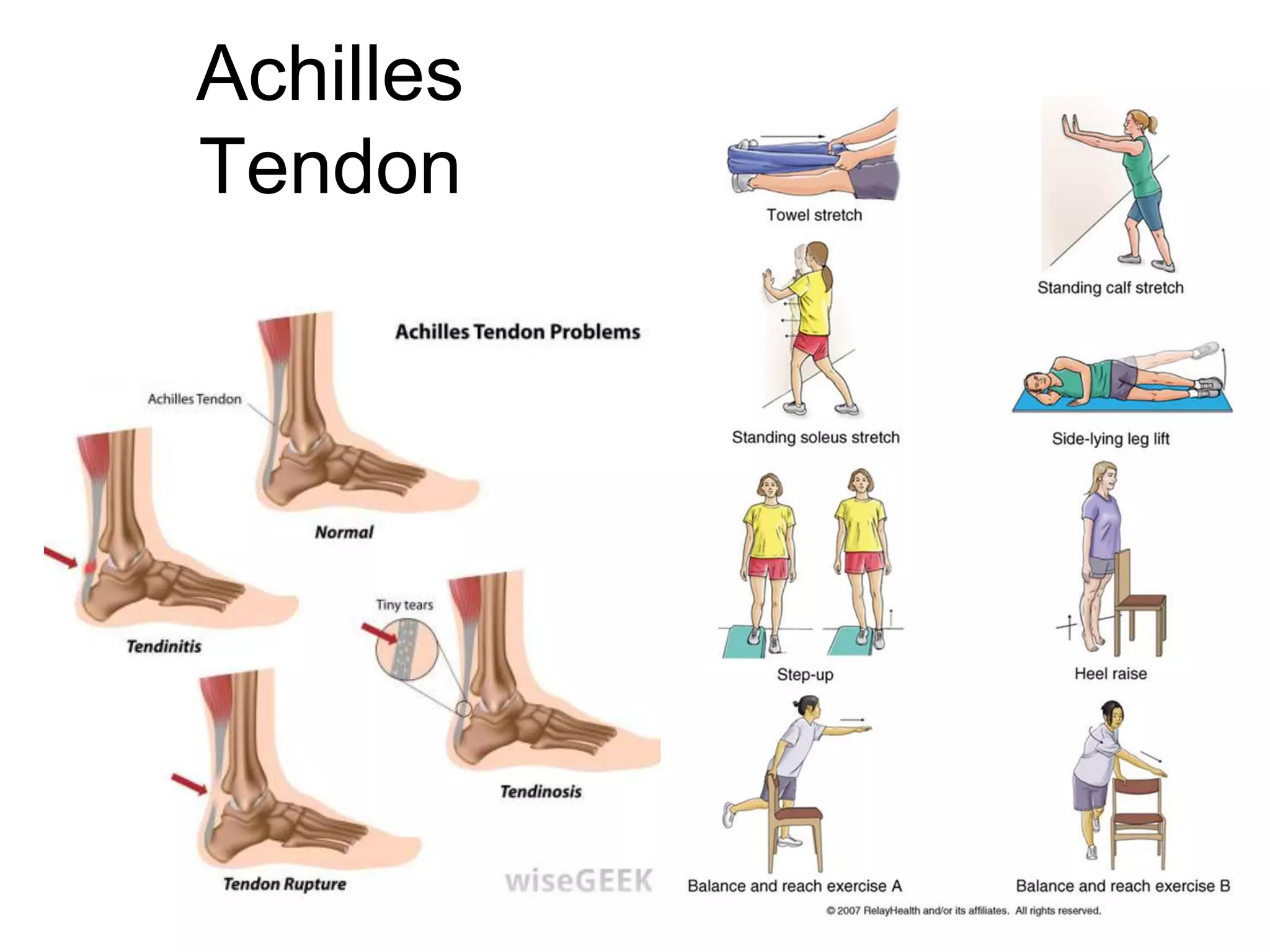 Achilles
Tendon
 