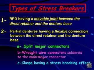 Direct Rpd 4)Stress Breakers Diagnosis and Examination .pptx