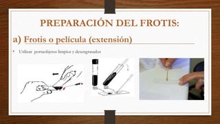a) Frotis o película (extensión)
• Utilizar portaobjetos limpios y desengrasados
PREPARACIÓN DEL FROTIS:
 