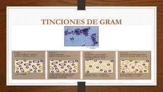 TINCIONES DE GRAM
 