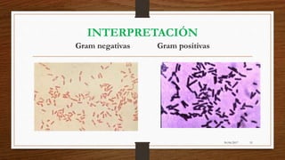 30/06/2017 51
INTERPRETACIÓN
Gram negativas Gram positivas
 