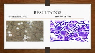 RESULTADOS
TINCIÓN NEGATIVA TINCIÓN DE HISS
 