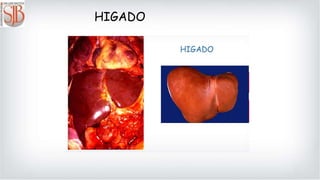 HIGADO
 
