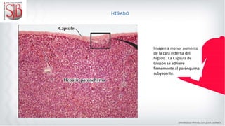 HIGADO
Imagen a menor aumento
de la cara externa del
hígado. La Cápsula de
Glisson se adhiere
firmemente al parénquima
subyacente.
 
