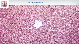 HÍGADO NORMAL
 