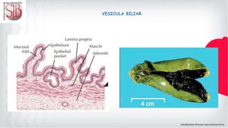 VESICULA BILIAR
 