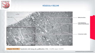 VESICULA BILIAR
 