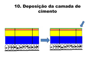 10. Deposição da camada de cimento  