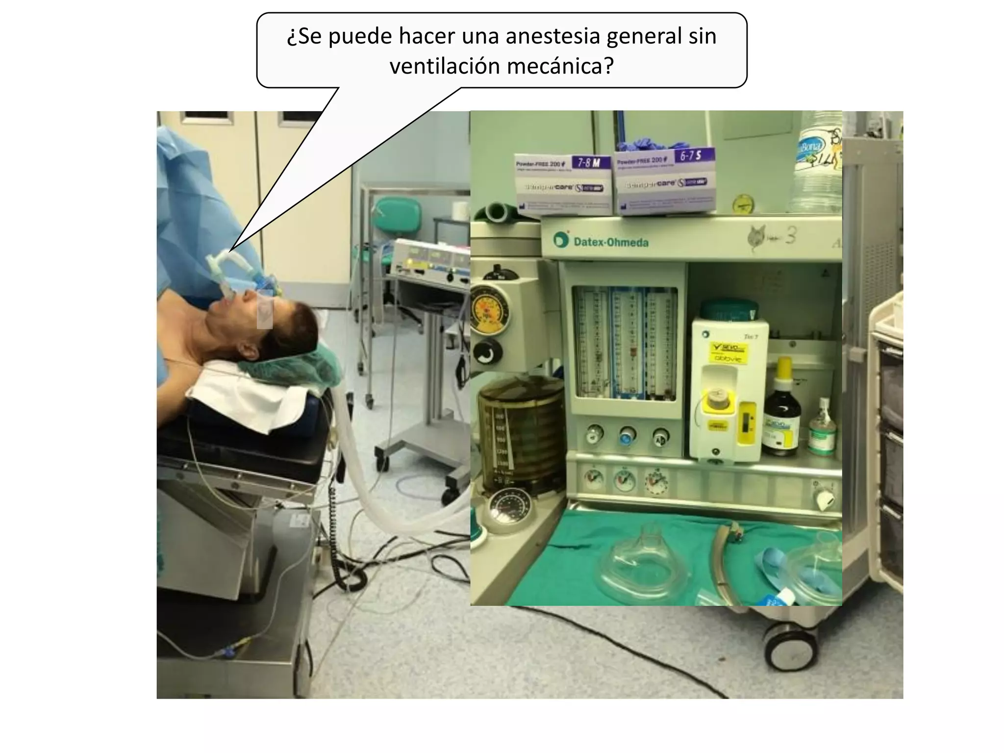 Tema 1 El Paciente Anestesiado Anestesia General Intravenosa PPT tema-1-el-paciente-anestesiado-anestesia-general-intravenosa-ppt