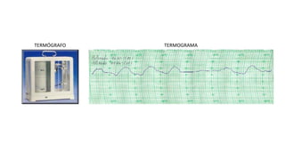 TERMÓGRAFO TERMOGRAMA
 