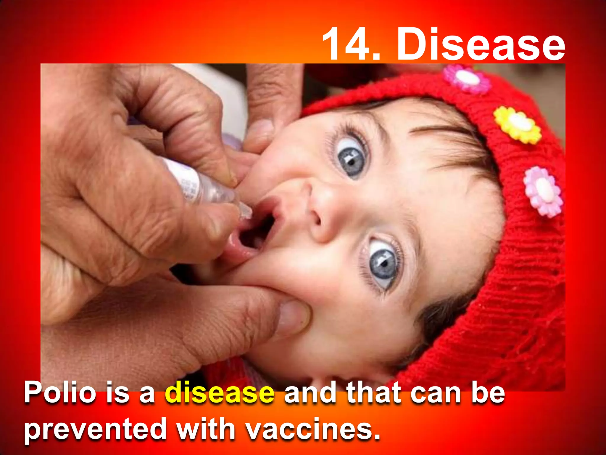 14. Disease
Polio is a disease and that can be
prevented with vaccines.