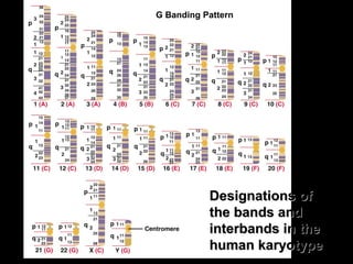Designations ofDesignations of
the bands andthe bands and
interbands in theinterbands in the
human karyotypehuman karyotype
G Banding Pattern
 