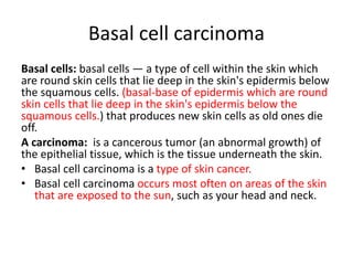 Basal cell carcinoma
Basal cells: basal cells — a type of cell within the skin which
are round skin cells that lie deep in the skin's epidermis below
the squamous cells. (basal-base of epidermis which are round
skin cells that lie deep in the skin's epidermis below the
squamous cells.) that produces new skin cells as old ones die
off.
A carcinoma: is a cancerous tumor (an abnormal growth) of
the epithelial tissue, which is the tissue underneath the skin.
• Basal cell carcinoma is a type of skin cancer.
• Basal cell carcinoma occurs most often on areas of the skin
that are exposed to the sun, such as your head and neck.
 