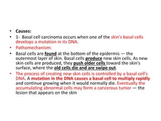 • Causes:
• 1- Basal cell carcinoma occurs when one of the skin's basal cells
develops a mutation in its DNA.
• Pathomechanism:
• Basal cells are found at the bottom of the epidermis — the
outermost layer of skin. Basal cells produce new skin cells. As new
skin cells are produced, they push older cells toward the skin's
surface, where the old cells die and are swipe out.
• The process of creating new skin cells is controlled by a basal cell's
DNA. A mutation in the DNA causes a basal cell to multiply rapidly
and continue growing when it would normally die. Eventually the
accumulating abnormal cells may form a cancerous tumor — the
lesion that appears on the skin
 