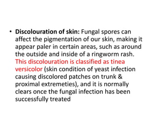 • Discolouration of skin: Fungal spores can
affect the pigmentation of our skin, making it
appear paler in certain areas, such as around
the outside and inside of a ringworm rash.
This discolouration is classified as tinea
versicolor (skin condition of yeast infection
causing discolored patches on trunk &
proximal extremeties), and it is normally
clears once the fungal infection has been
successfully treated
 