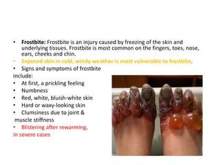 Frostbite Reticular Rash Adult Pustular lesions | PPTX