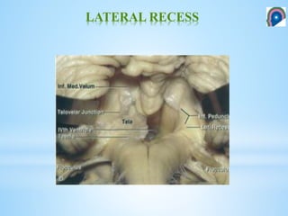 4 th ventricle- Anatomical and surgical perspective | PPTX
