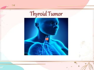Thyroid Tumor
.
 