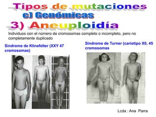 Individuos con el número de cromosomas completo o incompleto, pero no
completamente duplicado
Síndrome de Turner (cariotipo X0, 45
Síndrome de Klinefelter (XXY 47
cromosomas
cromosomas)

Lcda : Ana Parra

 