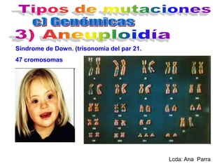 Síndrome de Down. (trisonomia del par 21.
47 cromosomas

Lcda: Ana Parra

 