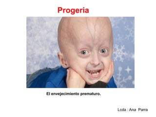 Progeria

El envejecimiento prematuro.

Lcda : Ana Parra

 