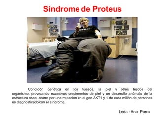 Síndrome de Proteus

Condición genética en los huesos, la piel y otros tejidos del
organismo, provocando excesivos crecimientos de piel y un desarrollo anómalo de la
estructura ósea. ocurre por una mutación en el gen AKT1 y 1 de cada millón de personas
es diagnosticado con el síndrome.

Lcda : Ana Parra

 