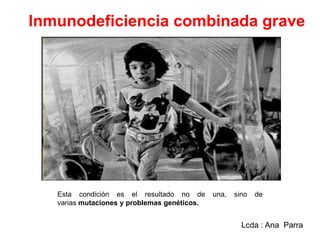 Inmunodeficiencia combinada grave

Esta condición es el resultado no de
varias mutaciones y problemas genéticos.

una,

sino

de

Lcda : Ana Parra

 