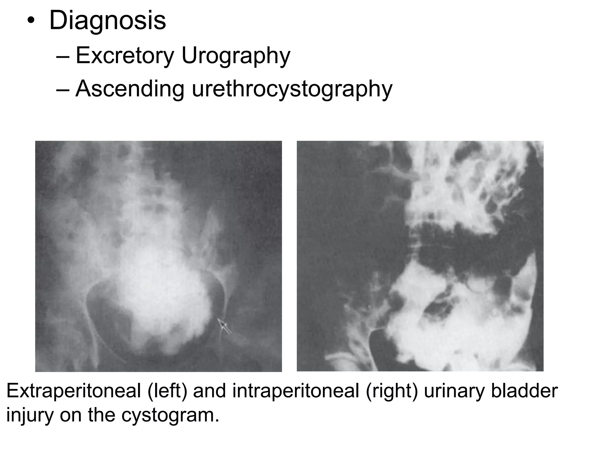 urology trauma (1).pptx