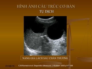 01/06/15 13
HÌNH ẢNH CẤU TRÚC CƠ BẢNHÌNH ẢNH CẤU TRÚC CƠ BẢN
TỤ DỊCHTỤ DỊCH
C.M.Rumack et al. Diagnostic Ultrasound. 3rd
Edition. 2005.p147-168
NANG GIẢ LÁCH SAU CHẤN THƯƠNG
 