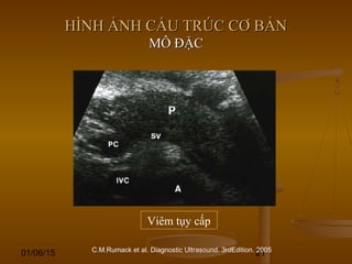 01/06/15 21
HÌNH ẢNH CẤU TRÚC CƠ BẢNHÌNH ẢNH CẤU TRÚC CƠ BẢN
MÔ ĐẶCMÔ ĐẶC
C.M.Rumack et al. Diagnostic Ultrasound. 3rdEdition. 2005
Viêm tụy cấp
 