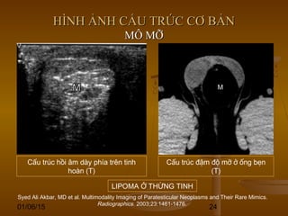 01/06/15 24
HÌNH ẢNH CẤU TRÚC CƠ BẢNHÌNH ẢNH CẤU TRÚC CƠ BẢN
MÔ MỠMÔ MỠ
Syed Ali Akbar, MD et al. Multimodality Imaging of Paratesticular Neoplasms and Their Rare Mimics.
Radiographics. 2003;23:1461-1476.
Cấu trúc hồi âm dày phía trên tinh
hoàn (T)
Cấu trúc đậm độ mỡ ở ống bẹn
(T)
LIPOMA Ở THỪNG TINH
 