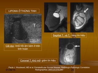 01/06/15 25
Paula J. Woodward, MD et al. Extratesticular Scrotal Masses: Radiologic-Pathologic Correlation.
Radiographics. 2003;23:215-240.
Cắt dọc: khối hồi âm kém ở trên
tinh hoàn
Sagittal T1 và T2: tăng tín hiệu
Coronal T2 khử mỡ: giảm tín hiệu
LIPOMA Ở THỪNG TINH
 