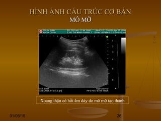 01/06/15 26
HÌNH ẢNH CẤU TRÚC CƠ BẢNHÌNH ẢNH CẤU TRÚC CƠ BẢN
MÔ MỠMÔ MỠ
Xoang thận có hồi âm dày do mô mỡ tạo thành
 
