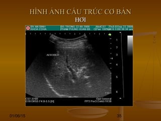 01/06/15 35
HÌNH ẢNH CẤU TRÚC CƠ BẢNHÌNH ẢNH CẤU TRÚC CƠ BẢN
HƠIHƠI
 