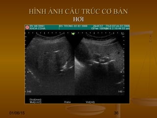 01/06/15 36
HÌNH ẢNH CẤU TRÚC CƠ BẢNHÌNH ẢNH CẤU TRÚC CƠ BẢN
HƠIHƠI
 