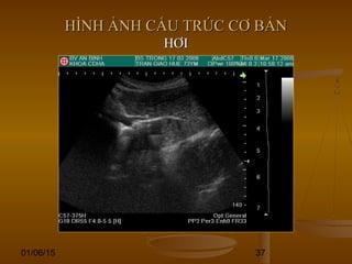 01/06/15 37
HÌNH ẢNH CẤU TRÚC CƠ BẢNHÌNH ẢNH CẤU TRÚC CƠ BẢN
HƠIHƠI
 