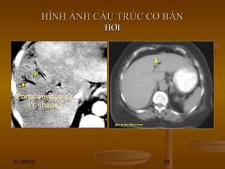 01/06/15 38
HÌNH ẢNH CẤU TRÚC CƠ BẢNHÌNH ẢNH CẤU TRÚC CƠ BẢN
HƠIHƠI
 