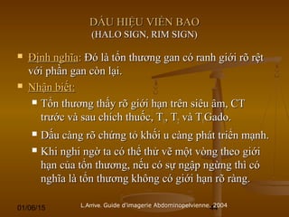 01/06/15 44
DẤU HIỆU VIỀN BAODẤU HIỆU VIỀN BAO
(HALO SIGN, RIM SIGN)(HALO SIGN, RIM SIGN)
 Định nghĩaĐịnh nghĩa:: Đó là tổn thương gan có ranh giới rõ rệtĐó là tổn thương gan có ranh giới rõ rệt
với phần gan còn lại.với phần gan còn lại.
 Nhận biết:Nhận biết:
 Tổn thương thấy rõ giới hạn trên siêu âm, CTTổn thương thấy rõ giới hạn trên siêu âm, CT
trước và sau chích thuốc, Ttrước và sau chích thuốc, T11, T, T22 và Tvà T11Gado.Gado.
 Dấu càng rõ chứng tỏ khối u càng phát triển mạnh.Dấu càng rõ chứng tỏ khối u càng phát triển mạnh.
 Khi nghi ngờ ta có thể thử vẽ một vòng theo giớiKhi nghi ngờ ta có thể thử vẽ một vòng theo giới
hạn của tổn thương, nếu có sự ngập ngừng thì cóhạn của tổn thương, nếu có sự ngập ngừng thì có
nghĩa là tổn thương không có giới hạn rõ ràng.nghĩa là tổn thương không có giới hạn rõ ràng.
L.Arrive. Guide d'imagerie Abdominopelvienne. 2004
 