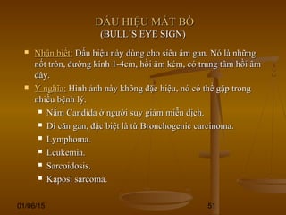 01/06/15 51
DẤU HIỆU MẮT BÒDẤU HIỆU MẮT BÒ
(BULL’S EYE SIGN)(BULL’S EYE SIGN)
 Nhận biết:Nhận biết: Dấu hiệu này dùng cho siêu âm gan. Nó là nhữngDấu hiệu này dùng cho siêu âm gan. Nó là những
nốt tròn, đường kính 1-4cm, hồi âm kém, có trung tâm hồi âmnốt tròn, đường kính 1-4cm, hồi âm kém, có trung tâm hồi âm
dày.dày.
 Ý nghĩa:Ý nghĩa: Hình ảnh này không đặc hiệu, nó có thể gặp trongHình ảnh này không đặc hiệu, nó có thể gặp trong
nhiều bệnh lý.nhiều bệnh lý.
 Nấm Candida ở người suy giảm miễn dịch.Nấm Candida ở người suy giảm miễn dịch.
 Di căn gan, đặc biệt là từ Bronchogenic carcinoma.Di căn gan, đặc biệt là từ Bronchogenic carcinoma.
 Lymphoma.Lymphoma.
 Leukemia.Leukemia.
 Sarcoidosis.Sarcoidosis.
 Kaposi sarcoma.Kaposi sarcoma.
 