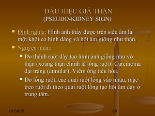 01/06/15 68
DẤU HIỆU GIẢ THẬNDẤU HIỆU GIẢ THẬN
(PSEUDO-KIDNEY SIGN)(PSEUDO-KIDNEY SIGN)
 Định nghĩa:Định nghĩa: Hình ảnh thấy được trên siêu âm làHình ảnh thấy được trên siêu âm là
một khối có hình dáng và hồi âm giống như thận.một khối có hình dáng và hồi âm giống như thận.
 Nguyên nhân:Nguyên nhân:
 Do thành ruột dày tạo hình ảnh giống như vỏDo thành ruột dày tạo hình ảnh giống như vỏ
thận (xoang thận chính là lòng ruột): Carcinomathận (xoang thận chính là lòng ruột): Carcinoma
đại tràng (annular), Viêm ống tiêu hóa.đại tràng (annular), Viêm ống tiêu hóa.
 Do lồng ruột, các quai ruột lồng vào nhau, mạcDo lồng ruột, các quai ruột lồng vào nhau, mạc
treo ruột đi theo quai ruột lồng tạo hồi âm dày ởtreo ruột đi theo quai ruột lồng tạo hồi âm dày ở
trung tâm.trung tâm.
 