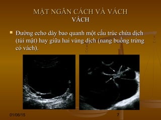 01/06/15 7
MẶT NGĂN CÁCH VÀ VÁCHMẶT NGĂN CÁCH VÀ VÁCH
VÁCHVÁCH
 Đường echo dày bao quanh một cấu trúc chứa dịchĐường echo dày bao quanh một cấu trúc chứa dịch
(túi mật) hay giữa hai vùng dịch (nang buồng trứng(túi mật) hay giữa hai vùng dịch (nang buồng trứng
có vách).có vách).
 