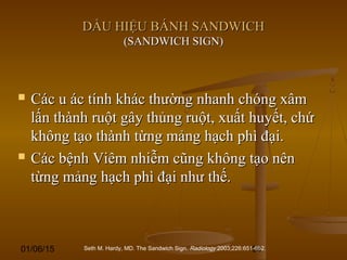 01/06/15 94
DẤU HIỆU BÁNH SANDWICHDẤU HIỆU BÁNH SANDWICH
(SANDWICH SIGN)(SANDWICH SIGN)
 Các u ác tính khác thường nhanh chóng xâmCác u ác tính khác thường nhanh chóng xâm
lấn thành ruột gây thủng ruột, xuất huyết, chứlấn thành ruột gây thủng ruột, xuất huyết, chứ
không tạo thành từng mảng hạch phì đại.không tạo thành từng mảng hạch phì đại.
 Các bệnh Viêm nhiễm cũng không tạo nênCác bệnh Viêm nhiễm cũng không tạo nên
từng mảng hạch phì đại như thế.từng mảng hạch phì đại như thế.
Seth M. Hardy, MD. The Sandwich Sign. Radiology 2003;226:651-652.
 