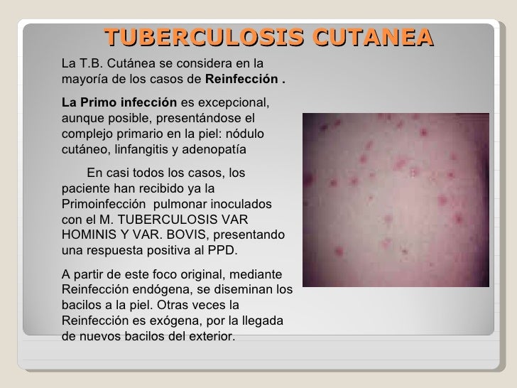 Resistencia Bacteriana de nueva generación. - Página 13 4-tuberculosissifilis-lepra-6-728