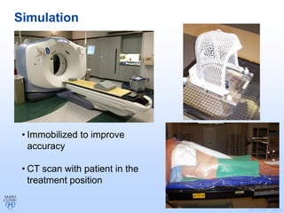 ©2011 MFMER | slide-13
Simulation
• Immobilized to improve
accuracy
• CT scan with patient in the
treatment position
 