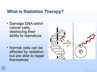 ©2011 MFMER | slide-5
What is Radiation Therapy?
• Damage DNA within
cancer cells,
destroying their
ability to reproduce
• Normal cells can be
affected by radiation,
but are able to repair
themselves
OH
 
