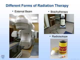 ©2011 MFMER | slide-6
Different Forms of Radiation Therapy
• External Beam • Brachytherapy
• Radioisotope
 