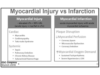 Fourth Universal Definition Of Myocardial Infarction (2018) | PPTX