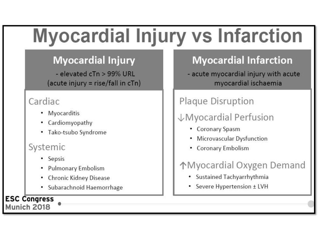 Fourth Universal Definition Of Myocardial Infarction (2018)
