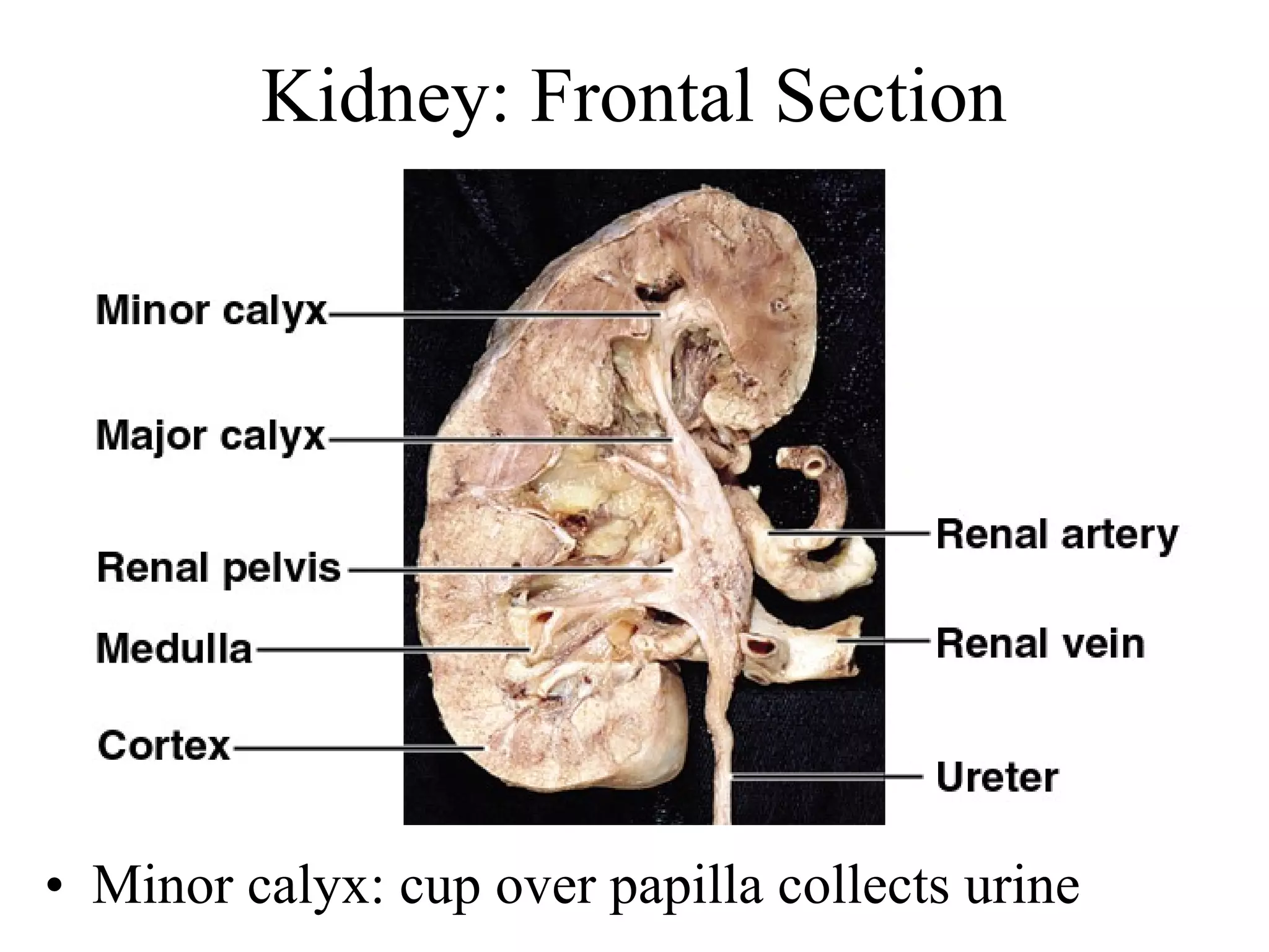 Kidney: Frontal Section
• Minor calyx: cup over papilla collects urine
 